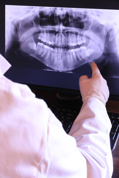 Best Emergency Dental Care for Broken or Chipped Teeth in New York, NY